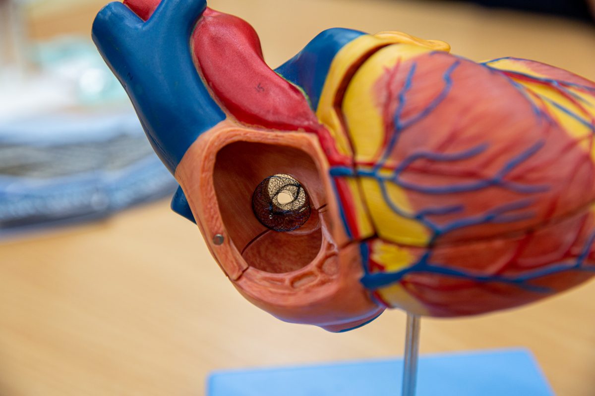 ‘อุปกรณ์ถ่างขยายผนังหัวใจห้องบน’ นวัตกรรมใหม่ทางการแพทย์ สู่การเปลี่ยนแปลงครั้งใหญ่ของการรักษาโรคหัวใจวายเฉียบพลัน ฝีมือนักวิจัยไทย